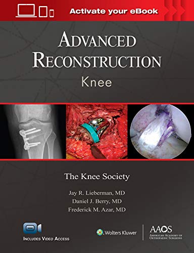 Beispielbild fr Advanced Reconstruction: Knee: Print + Ebook with Multimedia zum Verkauf von Better World Books Ltd