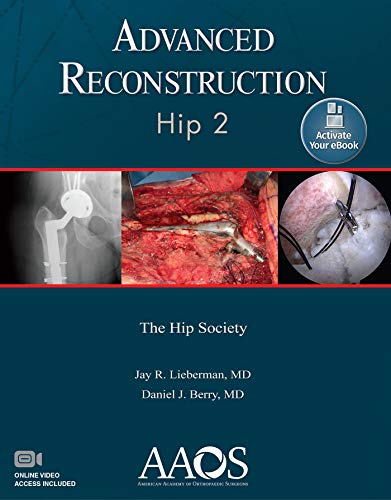 Imagen de archivo de Advanced Reconstruction: Hip 2: Print + Ebook with Multimedia (AAOS - American Academy of Orthopaedic Surgeons) a la venta por Scubibooks