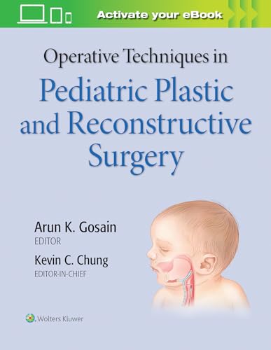 Imagen de archivo de Operative Techniques In Pediatric Plastic And Reconstructive Surgery With Access Code (Hb 2020) a la venta por Basi6 International