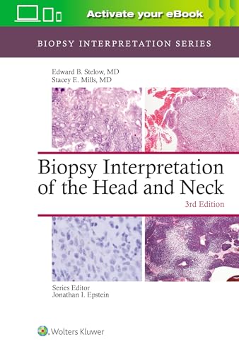 Imagen de archivo de Biopsy Interpretation of the Head and Neck (Biopsy Interpretation Series) a la venta por Scubibooks