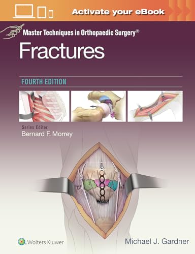 Stock image for Master Techniques in Orthopaedic Surgery: Fractures for sale by BooksRun