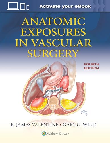 Beispielbild fr Anatomic Exposures in Vascular Surgery zum Verkauf von Scubibooks
