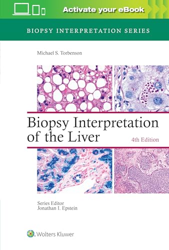 Beispielbild fr Biopsy Interpretation of the Liver (Biopsy Interpretation Series) zum Verkauf von BooksRun