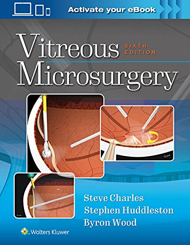 9781975168353: Vitreous Microsurgery