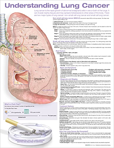 Imagen de archivo de Understanding Lung Cancer Anatomical Chart a la venta por GreatBookPrices