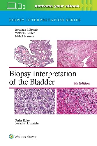 Imagen de archivo de Biopsy Interpretation of the Bladder (Biopsy Interpretation Series) a la venta por Scubibooks