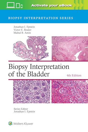 Stock image for Biopsy Interpretation of the Bladder (Biopsy Interpretation Series) for sale by Ria Christie Collections