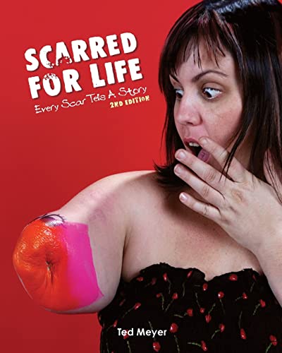 Beispielbild fr Scarred for Life. 2nd Edition: Every Scar Tells A Story zum Verkauf von HPB Inc.