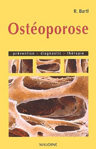 Beispielbild fr Ostoporose: Prvention, diagnostic, thrapie zum Verkauf von Ammareal