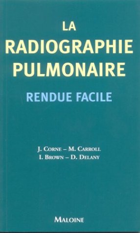 Beispielbild fr La Radiographie Pulmonaire Rendue Facile zum Verkauf von Kultgut