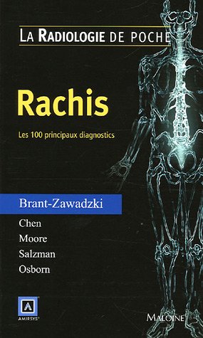 Beispielbild fr Rachis : Les 100 principaux diagnostics zum Verkauf von medimops