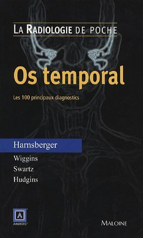 Imagen de archivo de Os temporal : Les 100 principaux diagnostics a la venta por medimops