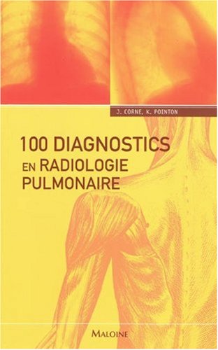 Stock image for 100 diagnostics en radiologie pulmonaire for sale by Ammareal