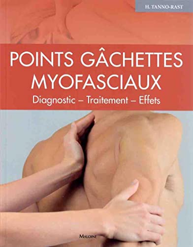 9782224034436: Points gchettes myofasciaux: Diagnostics - Traitement - Effets