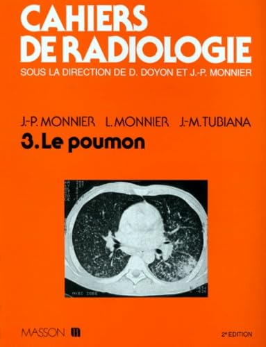 Imagen de archivo de Cahiers de radiologie. Le poumon a la venta por medimops