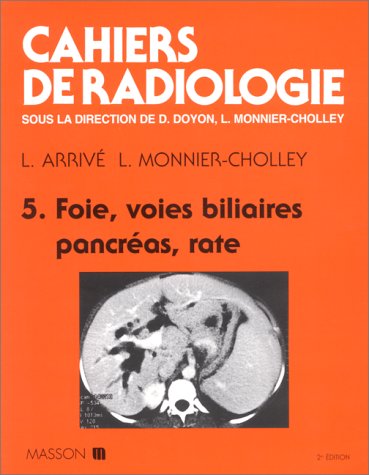 Beispielbild fr Cahiers De Radiologie Numero 5 : Foie, Voies Biliaires, Pancreas, Rate. 2eme Edition zum Verkauf von Ammareal