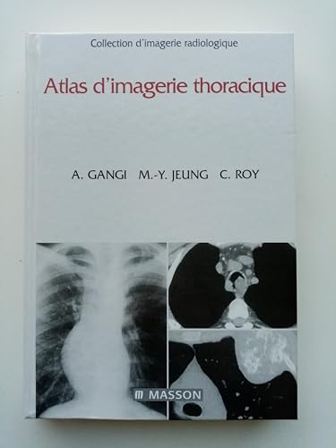 9782225835339: Atlas d'imagerie thoracique