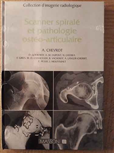 Stock image for Scanner spiral et pathologie osto-articulaire for sale by Ammareal