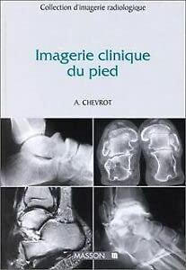 Stock image for Imagerie clinique du pied for sale by Ammareal