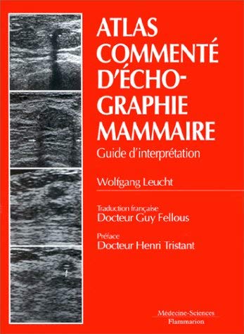 Stock image for Atlas comment d'chographie mammaire : Guide d'interprtation for sale by Ammareal
