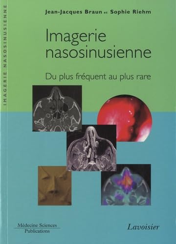 Beispielbild fr Imagerie nasosinusienne: Du plus frquent au plus rare zum Verkauf von Gallix