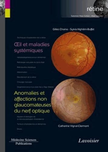 Beispielbild fr Oeil et maladies systmiques / Anomalies et affections non glaucomateuses du nerf optique (volume 5 - coffret Rtine): (volume 5 - coffret Rtine) zum Verkauf von Gallix