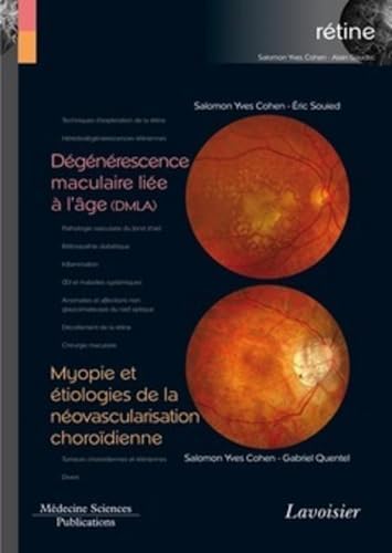 Stock image for Dgnrescence maculaire lie  l'ge (DMLA) / Myopie et tiologies de la novascularisation chorodienne (volume 7 - coffret Rtine): (volume 7 - coffret Rtine) for sale by Gallix