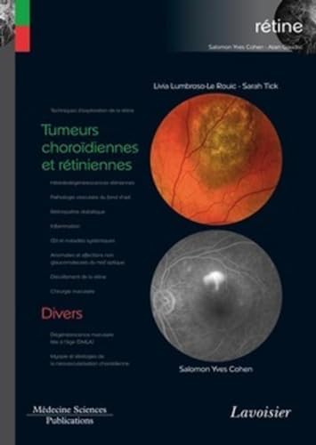 Stock image for Tumeurs chorodiennes et rtiniennes / Divers (volume 8 - coffret Rtine): (volume 8 - coffret Rtine) for sale by Gallix