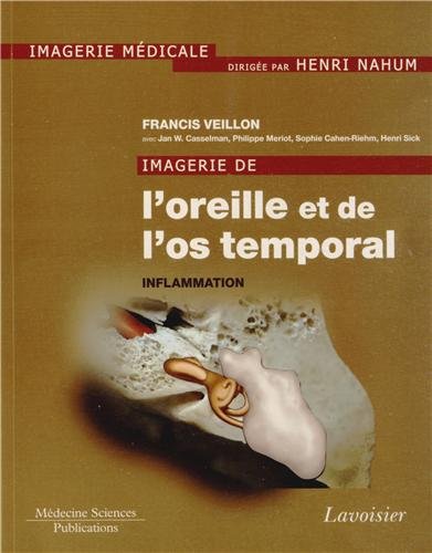 9782257205728: IMAGERIE DE L'OREILLE ET DE L'OS TEMPORAL - VOLUME 2. INFLAMMATION: Tome 2, Inflammation