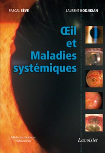 Imagen de archivo de Oeil et maladies systmiques a la venta por Ammareal