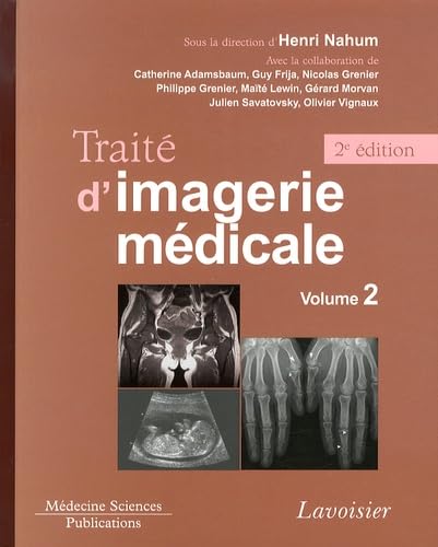 Stock image for Trait d'imagerie mdicale. Volume 2 (2 d.): Volume 2. Appareil urognital, os et articulations, radiopdiatrie for sale by Gallix