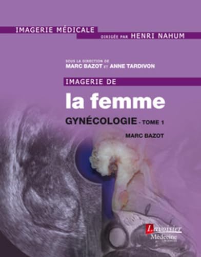 Beispielbild fr Imagerie de la femme : Gyncologie - Tome 1 zum Verkauf von Gallix