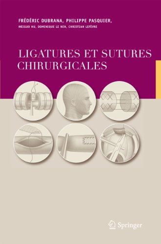 9782287251665: Ligatures Et Sutures Chirurgicales: Techniques Chirurgicales