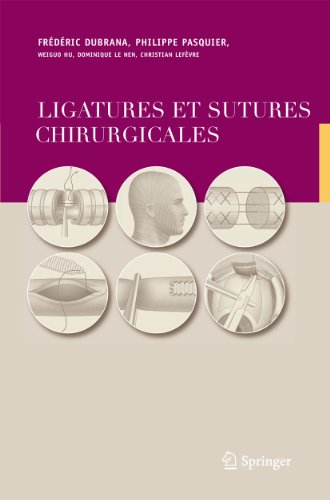 9782287251665: Ligatures et sutures chirurgicales: Techniques chirurgicales (French Edition)