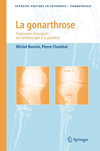 Beispielbild fr La gonarthrose: Traitement chirurgical: de larthroscopie  la prothse (Approche pratique en orthopdie-traumatologie) (French Edition) zum Verkauf von Gallix