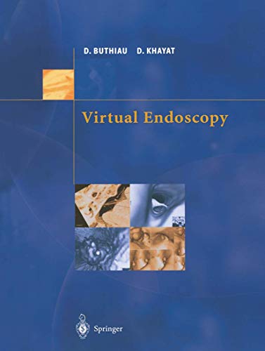 9782287596582: Virtual Endoscopy