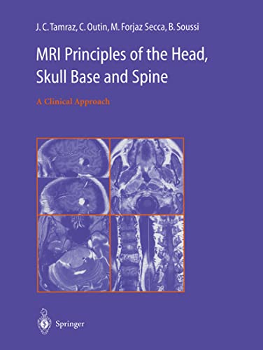 Stock image for MRI Principles of the Head, Skull Base and Spine for sale by Mispah books