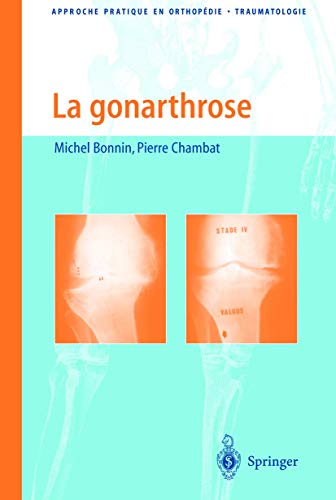 9782287597305: La gonarthrose: Traitement Chirurgical: de Larthroscopie a la Prothese