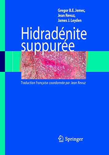 HidradÃ©nite suppurÃ©e (French Edition) (9782287720628) by James J. Leyden Jean Revuz Gregor B. E. Jemec