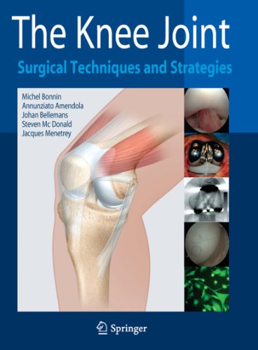 Beispielbild fr The Knee Joint: Surgical Techniques And Strategies zum Verkauf von RECYCLIVRE