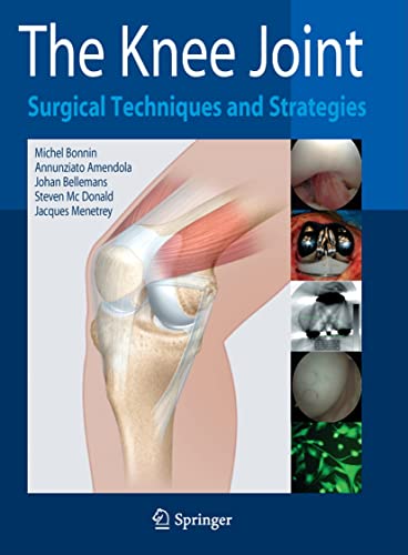 9782287993527: The Knee Joint: Surgical Techniques and Strategies