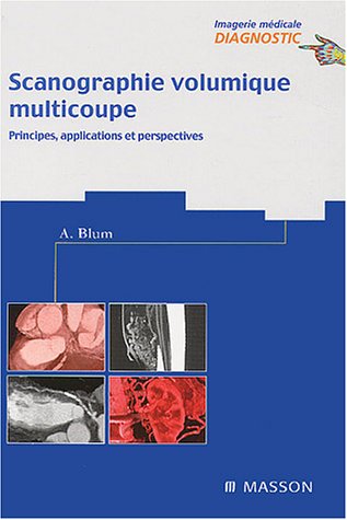 Scanographie volumique multicoupe: Principes, applications et perspectives (9782294007132) by Blum