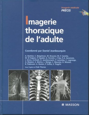 9782294009327: Imagerie thoracique de l'adulte