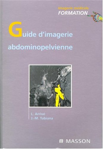 Stock image for Guide d'imagerie abdomino-pelvienne for sale by medimops
