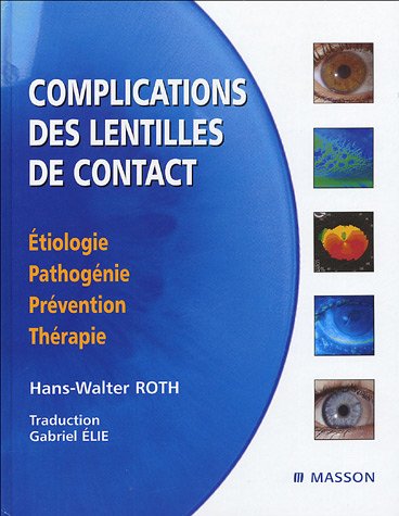 Beispielbild fr Complications des lentilles de contact: tiologie, pathognie, prvention, thrapie zum Verkauf von Gallix