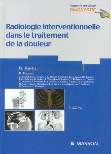 Stock image for Radiologie interventionnelle dans le traitement de la douleur for sale by Ammareal