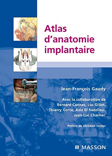 9782294050824: Atlas d'anatomie implantaire