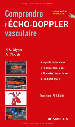 Beispielbild fr Comprendre l'cho-Doppler vasculaire zum Verkauf von medimops