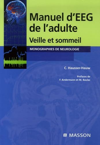 9782294071454: Manuel d'EEG de l'adulte: Veille et sommeil