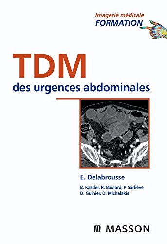 9782294706004: TDM des urgences abdominales